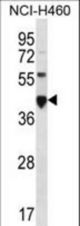 CEACAM18 Antibody western blot of NCI-H460 cell line lysates (35 ug/lane). The CEACAM18 antibody detected the CEACAM18 protein (arrow).