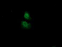 Anti-ADI1 mouse monoclonal antibody immunofluorescent staining of COS7 cells transiently transfected by pCMV6-ENTRY ADI1.