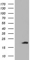 HEK293T cells were transfected with the pCMV6-ENTRY control (Left lane) or pCMV6-ENTRY ADI1 (Right lane) cDNA for 48 hrs and lysed. Equivalent amounts of cell lysates (5 ug per lane) were separated by SDS-PAGE and immunoblotted with anti-ADI1.