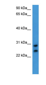CEACAM7 antibody LS-C135718 Western blot of HeLa lysate.