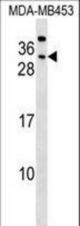 CEACAM7 Antibody western blot of MDA-MB453 cell line lysates (35 ug/lane). The CEACAM7 antibody detected the CEACAM7 protein (arrow).