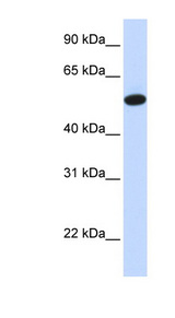 CEACAM16 antibody LS-C102146 Western blot of Fetal Liver lysate.
