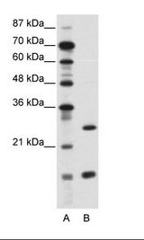 A: Marker, B: Jurkat Cell Lysate
