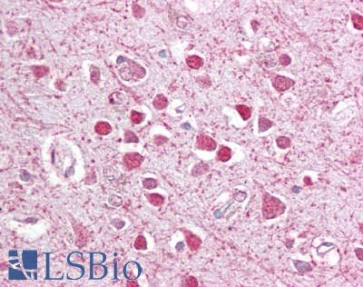Anti-CEBPG / CEBP Gamma antibody IHC of human brain, cortex. Immunohistochemistry of formalin-fixed, paraffin-embedded tissue after heat-induced antigen retrieval. Antibody LS-B6470 concentration 2.5 ug/ml.