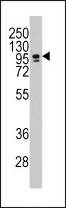 Western blot of anti-CEBPZ Antibody in NCI-H460 cell line lysates (35 ug/lane). CEBPZ(arrow) was detected using the purified antibody.
