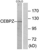 Western blot of extracts from COLO cells, using CEBPZ Antibody. The lane on the right is treated with the synthesized peptide.