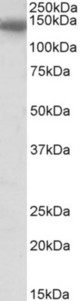CEBPZ antibody (0.5 ug/ml) staining of Mouse fetal Brain lysate (35 ug protein in RIPA buffer). Primary incubation was 1 hour. Detected by chemiluminescence.