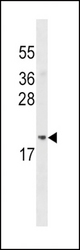 ADI1 Antibody western blot of MDA-MB453 cell line lysates (35 ug/lane). The ADI1 antibody detected the ADI1 protein (arrow).