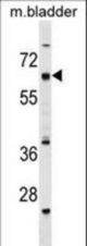 CECR6 Antibody western blot of mouse bladder tissue lysates (35 ug/lane). The CECR6 antibody detected the CECR6 protein (arrow).