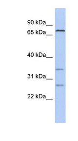 CEL antibody LS-C109837 Western blot of SH-SYSY lysate.