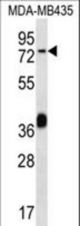 CEL Antibody western blot of MDA-MB435 cell line lysates (35 ug/lane). The CEL antibody detected the CEL protein (arrow).