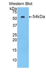 Western blot of recombinant CEL / Carboxyl Ester Lipase.