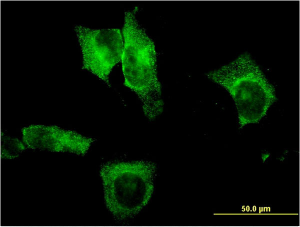 Immunofluorescence of monoclonal antibody to CEL on HeLa cell . [antibody concentration 10 ug/ml]
