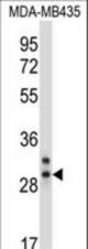 CELA2A Antibody western blot of MDA-MB435 cell line lysates (35 ug/lane). The CELA2A antibody detected the CELA2A protein (arrow).