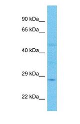 Western blot of CEL2A Antibody with human Large intestine Tumor lysate.