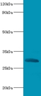 Western blot of Chymotrypsin-like elastase family member 2A antibody at 2 ug/ml with recombinant Chymotrypsin-like elastase family member 2A protein 0.1 ug Secondary Goat polyclonal to Rabbit lgG at 1:15000 dilution. Predicted band size: 29 KDa. Observed band size: 29 KDa.