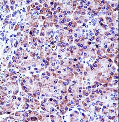 CELA3A Antibody immunohistochemistry of formalin-fixed and paraffin-embedded human pancreas tissue followed by peroxidase-conjugated secondary antibody and DAB staining.