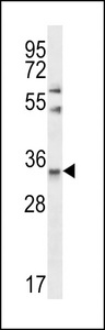 CELA3A Antibody western blot of Jurkat cell line lysates (35 ug/lane). The CELA3A antibody detected the CELA3A protein (arrow).