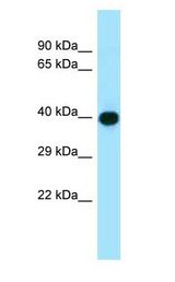 ADIPOR1 / Adiponectin Receptor antibody Western Blot of MDA-MB-435S.