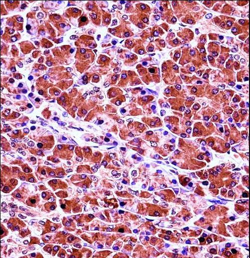 CELA3B Antibody immunohistochemistry of formalin-fixed and paraffin-embedded human pancreas tissue followed by peroxidase-conjugated secondary antibody and DAB staining.