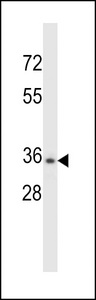 CELA3B Antibody western blot of NCI-H460 cell line lysates (35 ug/lane). The CELA3B antibody detected the CELA3B protein (arrow).