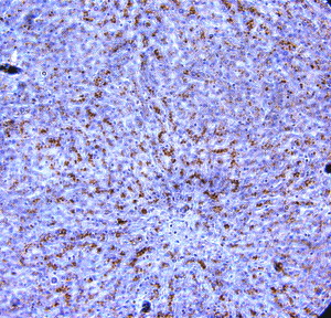 IHC of ADIPOR1 / Adiponectin Receptor antibody LS-C83993. Formalin-fixed, paraffin-embedded human liver.