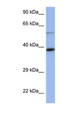 CELF1 / CUGBP1 antibody LS-B5702 Western blot of 3 Cell lysate. Antibody concentration 1 ug/ml.