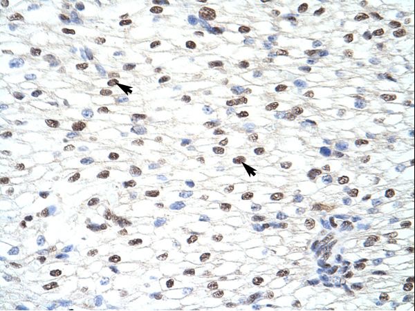 CELF2 / CUGBP2 antibody LS-C31676 was used in IHC to stain formalin-fixed, paraffin-embedded human heart.