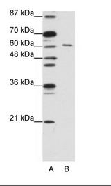 A: Marker, B: Jurkat Cell Lysate
