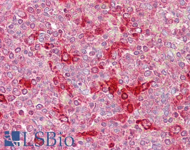Anti-CELF2 / CUGBP2 antibody IHC of human spleen. Immunohistochemistry of formalin-fixed, paraffin-embedded tissue after heat-induced antigen retrieval. Antibody LS-B6819 concentration 5 ug/ml.