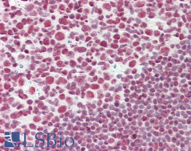 Anti-CELF2 / CUGBP2 antibody IHC staining of human tonsil. Immunohistochemistry of formalin-fixed, paraffin-embedded tissue after heat-induced antigen retrieval.