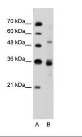 A: Marker, B: Jurkat Cell Lysate