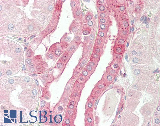 Anti-CELF3 antibody IHC staining of human kidney. Immunohistochemistry of formalin-fixed, paraffin-embedded tissue after heat-induced antigen retrieval. Antibody LS-B10033 dilution 1:100.