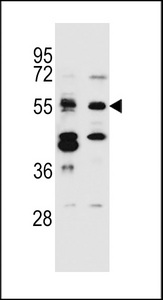 TNRC4 Antibody western blot of Jurkat,MDA-MB231 cell line lysates (35 ug/lane). The TNRC4 antibody detected the TNRC4 protein (arrow).