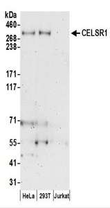 Detection of Human CELSR1 by Western Blot. Samples: Whole cell lysate (50 ug) prepared using NETN buffer from HeLa, 293T, and Jurkat cells. Antibodies: Affinity purified rabbit anti-CELSR1 antibody used for WB at 0.1 ug/ml. Detection: Chemiluminescence with an exposure time of 3 minutes.