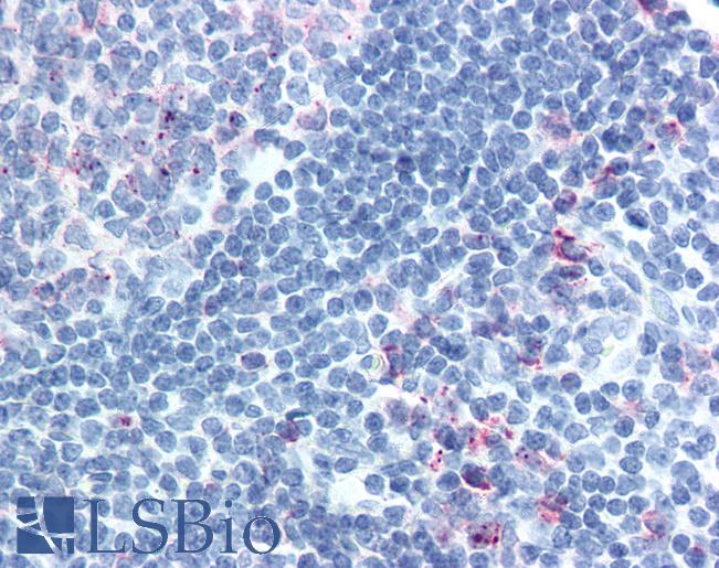 Anti-CELSR1 antibody LS-A5624 IHC of human tonsil. Immunohistochemistry of formalin-fixed, paraffin-embedded tissue after heat-induced antigen retrieval.