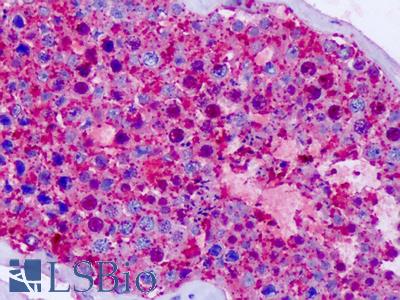 Anti-CELSR1 antibody IHC of human testis. Immunohistochemistry of formalin-fixed, paraffin-embedded tissue after heat-induced antigen retrieval. Antibody LS-A5364 concentration 8.4 ug/ml.