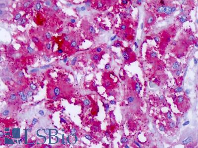 Anti-CELSR1 antibody IHC of human adrenal. Immunohistochemistry of formalin-fixed, paraffin-embedded tissue after heat-induced antigen retrieval. Antibody LS-A5364 concentration 8.4 ug/ml.