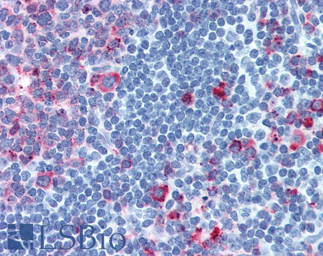Anti-CELSR1 antibody IHC of human tonsil. Immunohistochemistry of formalin-fixed, paraffin-embedded tissue after heat-induced antigen retrieval. Antibody LS-A5364 concentration 8.4 ug/ml.