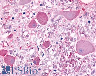 Anti-CELSR1 antibody LS-A5367 IHC of human brain. Immunohistochemistry of formalin-fixed, paraffin-embedded tissue after heat-induced antigen retrieval.
