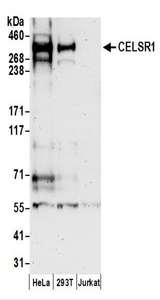 Detection of Human CELSR1 by Western Blot. Samples: Whole cell lysate (50 ug) prepared using NETN buffer from HeLa, 293T, and Jurkat cells. Antibodies: Affinity purified rabbit anti-CELSR1 antibody used for WB at 0.4 ug/ml. Detection: Chemiluminescence with an exposure time of 3 minutes.