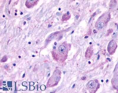 Anti-CELSR1 antibody LS-A1909 IHC of human brain. Immunohistochemistry of formalin-fixed, paraffin-embedded tissue after heat-induced antigen retrieval.