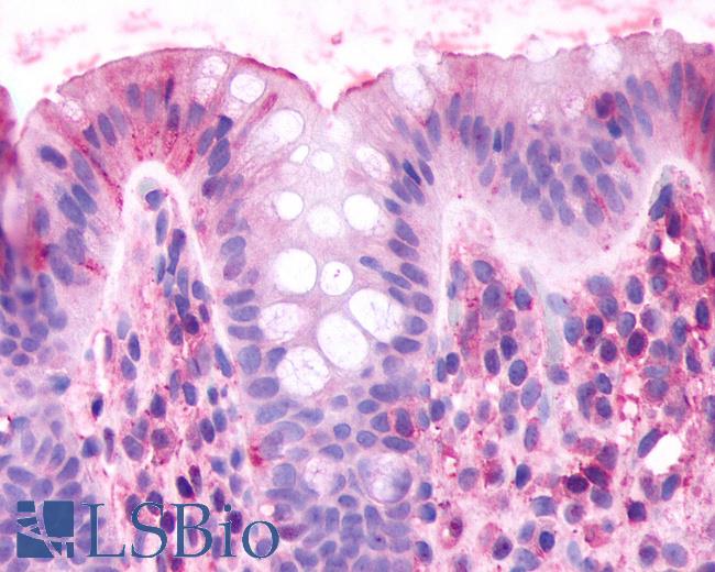 Anti-CELSR2 antibody IHC of human colon. Immunohistochemistry of formalin-fixed, paraffin-embedded tissue after heat-induced antigen retrieval.