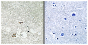 IHC of paraffin-embedded human brain tissue, using CELSR2 Antibody. The sample on the right was incubated with synthetic peptide.