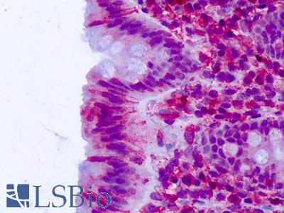 Anti-CELSR2 antibody IHC of human colon, epithelium. Immunohistochemistry of formalin-fixed, paraffin-embedded tissue after heat-induced antigen retrieval. Antibody LS-A1939 concentration 3-5 ug/ml.