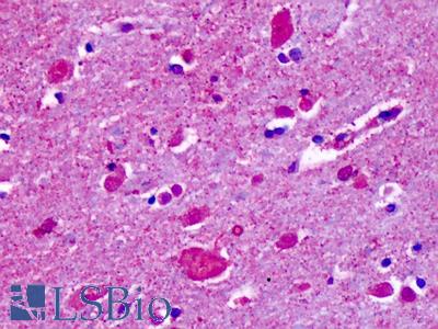 Anti-CELSR2 antibody IHC of human brain, cortex, cerebellum. Immunohistochemistry of formalin-fixed, paraffin-embedded tissue after heat-induced antigen retrieval. Antibody LS-A1939 concentration 3-5 ug/ml.