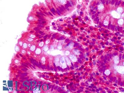 Anti-CELSR2 antibody IHC of human colon, epithelium. Immunohistochemistry of formalin-fixed, paraffin-embedded tissue after heat-induced antigen retrieval. Antibody LS-A1943 dilution 7 ug/ml.