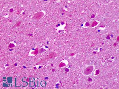 Anti-CELSR2 antibody IHC of human brain, cortex, neurons. Immunohistochemistry of formalin-fixed, paraffin-embedded tissue after heat-induced antigen retrieval. Antibody LS-A1943 dilution 7 ug/ml.