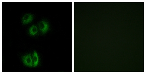 Immunofluorescence of A549 cells, using CELSR3 Antibody. The picture on the right is treated with the synthesized peptide.