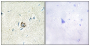 IHC of paraffin-embedded human brain tissue, using CELSR3 Antibody. The picture on the right is treated with the synthesized peptide.